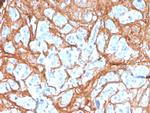 Periostin (POSTN) Antibody in Immunohistochemistry (Paraffin) (IHC (P))