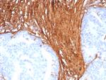 Periostin (POSTN) Antibody in Immunohistochemistry (Paraffin) (IHC (P))