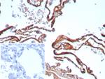 Periostin (POSTN) Antibody in Immunohistochemistry (Paraffin) (IHC (P))