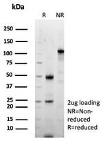 Periostin (POSTN) Antibody in SDS-PAGE (SDS-PAGE)