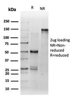 DMRT2 (Transcription Factor) Antibody in SDS-PAGE (SDS-PAGE)