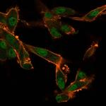 CELF2/CUGBP2 (RNA-binding protein) Antibody in Immunocytochemistry (ICC/IF)