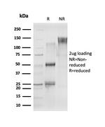 CELF2/CUGBP2 (RNA-binding protein) Antibody in SDS-PAGE (SDS-PAGE)