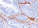 Nestin Antibody in Immunohistochemistry (Paraffin) (IHC (P))