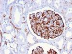 Nestin Antibody in Immunohistochemistry (Paraffin) (IHC (P))