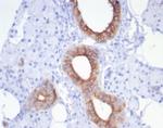 CFTR (Cystic Fibrosis Transmembrane Conductance Regulator) Antibody in Immunohistochemistry (Paraffin) (IHC (P))