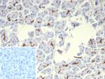 CFTR (Cystic Fibrosis Transmembrane Conductance Regulator) Antibody in Immunohistochemistry (Paraffin) (IHC (P))