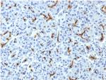 CFTR (Cystic Fibrosis Transmembrane Conductance Regulator) Antibody in Immunohistochemistry (Paraffin) (IHC (P))