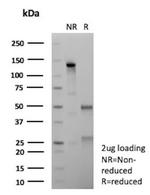 CFTR (Cystic Fibrosis Transmembrane Conductance Regulator) Antibody in SDS-PAGE (SDS-PAGE)