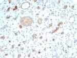 CFTR (Cystic Fibrosis Transmembrane Conductance Regulator) Antibody in Immunohistochemistry (Paraffin) (IHC (P))