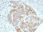 CFTR (Cystic Fibrosis Transmembrane Conductance Regulator) Antibody in Immunohistochemistry (Paraffin) (IHC (P))