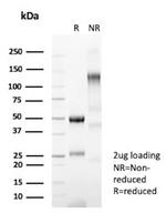 CFTR (Cystic Fibrosis Transmembrane Conductance Regulator) Antibody in SDS-PAGE (SDS-PAGE)