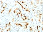 CFTR (Cystic Fibrosis Transmembrane Conductance Regulator) Antibody in Immunohistochemistry (Paraffin) (IHC (P))