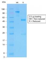 CFTR (Cystic Fibrosis Transmembrane Conductance Regulator) Antibody in SDS-PAGE (SDS-PAGE)