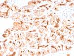 CFTR (Cystic Fibrosis Transmembrane Conductance Regulator) Antibody in Immunohistochemistry (Paraffin) (IHC (P))