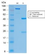 CFTR (Cystic Fibrosis Transmembrane Conductance Regulator) Antibody in SDS-PAGE (SDS-PAGE)