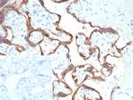 HCG-beta (Pregnancy and Choriocarcinoma Marker) Antibody in Immunohistochemistry (Paraffin) (IHC (P))