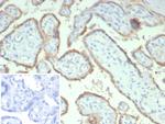 HCG-beta (Pregnancy and Choriocarcinoma Marker) Antibody in Immunohistochemistry (Paraffin) (IHC (P))