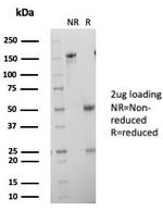 HCG-beta (Pregnancy and Choriocarcinoma Marker) Antibody in SDS-PAGE (SDS-PAGE)