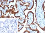 HCG-beta (Pregnancy and Choriocarcinoma Marker) Antibody in Immunohistochemistry (Paraffin) (IHC (P))