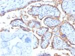 HCG-beta (Pregnancy and Choriocarcinoma Marker) Antibody in Immunohistochemistry (Paraffin) (IHC (P))