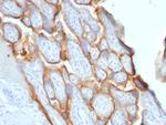 HCG-beta Antibody in Immunohistochemistry (Paraffin) (IHC (P))