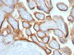 HCG-beta Antibody in Immunohistochemistry (Paraffin) (IHC (P))