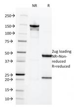 HCG-beta Antibody in SDS-PAGE (SDS-PAGE)