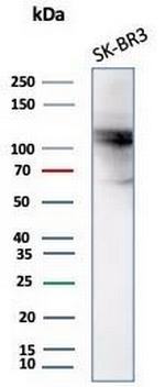 ALDH1L1 Antibody in Western Blot (WB)