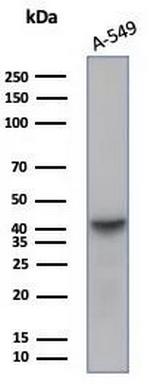 ALDH1L1 Antibody in Western Blot (WB)