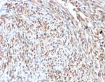 CDK4 Antibody in Immunohistochemistry (Paraffin) (IHC (P))