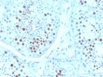 KIF2C (Kinesin Family Member 2C)/MCAK Antibody in Immunohistochemistry (Paraffin) (IHC (P))