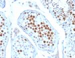 KIF2C (Kinesin Family Member 2C)/MCAK Antibody in Immunohistochemistry (Paraffin) (IHC (P))