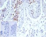 KIF2C (Kinesin Family Member 2C)/MCAK Antibody in Immunohistochemistry (Paraffin) (IHC (P))