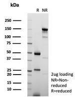 KIF2C (Kinesin Family Member 2C)/MCAK Antibody in SDS-PAGE (SDS-PAGE)