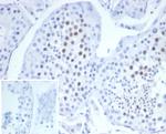 KIF2C (Kinesin Family Member 2C)/MCAK Antibody in Immunohistochemistry (Paraffin) (IHC (P))