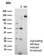 KIF2C (Kinesin Family Member 2C)/MCAK Antibody in SDS-PAGE (SDS-PAGE)