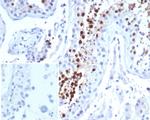 KIF2C (Kinesin Family Member 2C)/MCAK Antibody in Immunohistochemistry (Paraffin) (IHC (P))