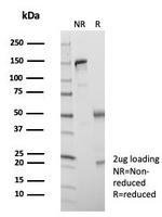 KIF2C (Kinesin Family Member 2C)/MCAK Antibody in SDS-PAGE (SDS-PAGE)