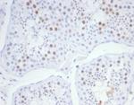 KIF2C (Kinesin Family Member 2C)/MCAK Antibody in Immunohistochemistry (Paraffin) (IHC (P))