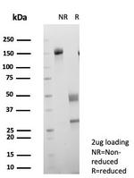 KIF2C (Kinesin Family Member 2C)/MCAK Antibody in SDS-PAGE (SDS-PAGE)