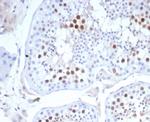 KIF2C (Kinesin Family Member 2C)/MCAK Antibody in Immunohistochemistry (Paraffin) (IHC (P))