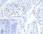 KIF2C (Kinesin Family Member 2C)/MCAK Antibody in Immunohistochemistry (Paraffin) (IHC (P))