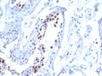 KIF2C (Kinesin Family Member 2C)/MCAK Antibody in Immunohistochemistry (Paraffin) (IHC (P))