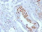 KIF2C (Kinesin Family Member 2C)/MCAK Antibody in Immunohistochemistry (Paraffin) (IHC (P))