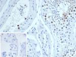 KIF2C (Kinesin Family Member 2C)/MCAK Antibody in Immunohistochemistry (Paraffin) (IHC (P))