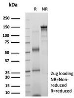 KIF2C (Kinesin Family Member 2C)/MCAK Antibody in SDS-PAGE (SDS-PAGE)