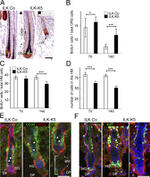 CD34 Antibody in Immunohistochemistry (IHC)