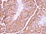 Uroplakin 1A Antibody in Immunohistochemistry (Paraffin) (IHC (P))