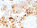 Uroplakin 1A Antibody in Immunohistochemistry (Paraffin) (IHC (P))